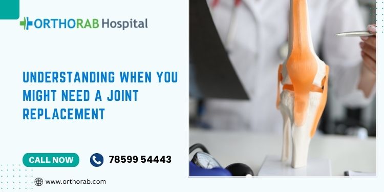 Understanding When You Might Need a Joint Replacement